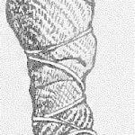 Fig. 15. Crooked Knife